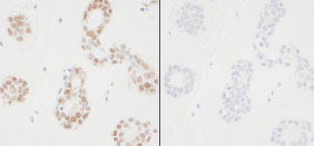 ab85000 at 1/250 dilution (incubated for 18 hours at room temperature) staining PCNA in serial sections of human breast tissue by Immunohistochemistry, Formalin-fixed, Paraffin-embedded tissue. Detection: DAB staining. Mock phosphatase treated section (left) or calf intestinal phosphatase-treated section (right).