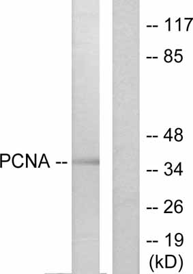 All lanes : Anti-PCNA antibody (ab53048) at 1/500 dilutionLane 1 : HepG2 cell lysateLane 2 : HepG2 cell lysate with immunising peptide