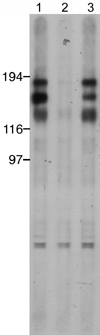 All lanes : Anti-NMDAR2A (phospho Y1325) antibody (ab16646) at 1 µg/mlLane 1 : mouse brain lysateLane 2 : mouse brain lysate with Mouse NMDAR2A (phospho Y1325) peptide (ab16985) at 1 µg/mlLane 3 : mouse brain lysate with Mouse NMDAR2A peptide (ab16990) at 1 µg/mlLysates/proteins at 20 µg per lane.Performed under reducing conditions.