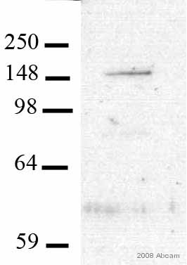 Anti-NMDAR2A antibody (ab14596) at 1/1000 dilution + whole cell lysate of synaptosomes of rat hippocampus at 15 µgSecondaryHRP-conjugated goat anti-rabbit antibody at 1/10000 dilutiondeveloped using the ECL techniqueObserved band size : 160 kDa (why is the actual band size different from the predicted?)Exposure time :  1 minuteThis image is courtesy of an Abreview submitted by Dr Sophie PezetSee Abreview
