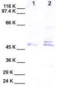 All lanes : Anti-PCOLE2 antibody (ab28345)Lane 1 : Cell media from human neonatal dermal fibroblastsLane 2 : Cell media from human neonatal dermal fibroblasts (treated with TPA)Observed band size : 50,53 kDa (why is the actual band size different from the predicted?)