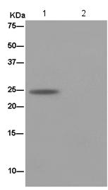 Western blot analysis on immunoprecipitation from Human fetal liver lysate (Lane 1), labeling PCTP using ab184944 at 1/50 dilution Lane 2 shows PBS negative control. Secondary antibody, HRP-conjugated anti-rabbit IgG preferentially detecting the non-reduced form of rabbit IgG at a 1/1500 dilution.