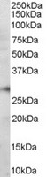 Anti-PD1 antibody (ab117420) at 0.6 µg/ml + Human Bone Marrow lysate in RIPA buffer at 35 µgdeveloped using the ECL technique