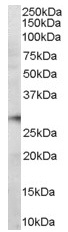 Anti-PD1 antibody (ab36151) at 2 µg/ml + Human Bone Marrow lysate (35ug protein in RIPA buffer).