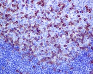 Immunohistochemical analysis of paraffin embedded Human tonsil tissue labelling PD1 using ab137132 at a dilution of 1/250.