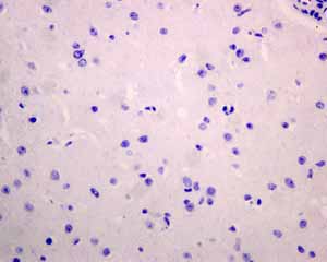 Immunohistochemical analysis using ab137132 showing negative staining in Normal brain tissue.