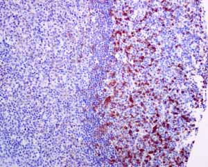 Immunohistochemical analysis using ab137132 showing positive staining in Normal tonsil tissue.
