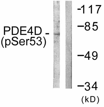 All lanes : Anti-PDE4D (phospho S190) antibody (ab59212) at 1/500 dilutionLane 1 : K562 cell extract treated with H2O2 (100uM, 30mins)Lane 2 : K562 cell extract treated with H2O2 (100uM, 30mins) with immunising peptide