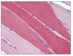 Immunohistochemical analysis of PDE4D expression in formalin-fixed, paraffin-embedded Human skeletal muscle tissue using ab112018 at 5 µg/ml.