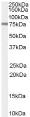 Anti-PDE4D3 antibody (ab59021) at 0.01 µg/ml + Rat Brain lysate (35µg protein in RIPA buffer)Observed band size : 77 kDa (why is the actual band size different from the predicted?)