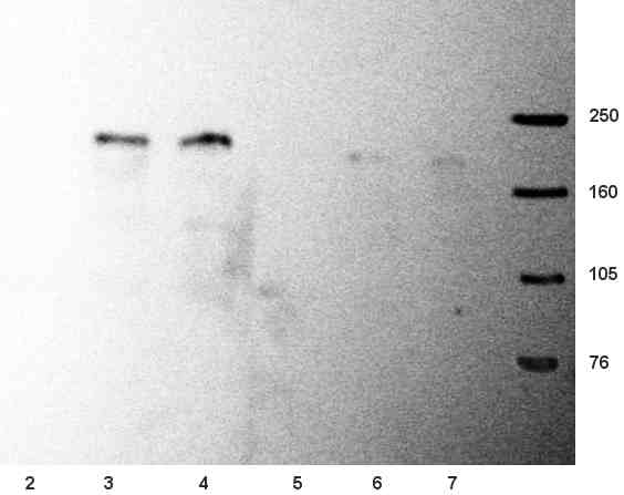 Lanes 2 - 4 :  Anti-NMDAR2B antibody [NR2B] (ab28373) at 1/500 dilutionLanes 5 - 7 :  Anti-NMDAR2B antibody [NR2B] (ab28373) at 1/1000 dilutionLane 2 : As aboveLane 3 : Mouse brain (50ug)Lane 4 : Rat brain (50ug)Lane 5 : As aboveLane 6 : Mouse brain (50ug)Lane 7 : Rat brain (50ug)