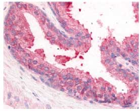Immunohistochemistry analysis of human Prostate tissue (Formalin-Fixed Paraffin-Embedded) using ab61815 at 10&microg/ml.