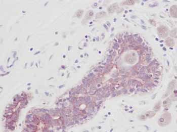 ab9701 at 1.0 µg/ml staining normal human skin by IHC-P. The antibody was incubated overnight at 4˚C. An HRP-labeled polymer detection system was used with a non-alcohol soluble AEC chromogen and a proteinase K antigen retrieval.