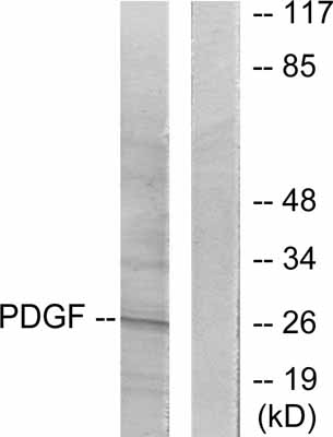 All lanes : Anti-PDGF BB antibody (ab53716) at 1/500 dilutionLane 1 : Extracts from NIH/3T3 cellsLane 2 : Extracts from NIH/3T3 cells, plus immunizing peptide