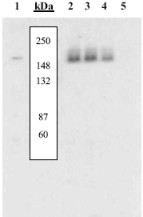 Peptide Competition: Extracts prepared from NIH3T3 cells left unstimulated (1) and stimulated with PDGF (2-5) were resolved by SDS-PAGE on a 10% polyacrylamide gel and transferred to PVDF. Membranes were blocked with a 5% BSA-TBST buffer overnight at 4°C, then were incubated with 0.50 µg/mL ab5452 antibody for two hours at room temperature in a 1% BSA-TBST buffer, following prior incubation with: no peptide (1, 2), the nonphosphopeptide corresponding to the immunogen (3), a generic phosphotyrosine containing peptide (4), or, the phosphopeptide immunogen (5). After washing, membranes were incubated with goat F(ab’)2 anti-rabbit IgG alkaline phosphatase and bands were detected using the Tropix WesternStar method. The data show that only the peptide corresponding to ab5452 blocks the antibody signal, thereby demonstrating the specificity of the antibody.
