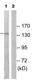 All lanes : Anti-PDGF Receptor alpha (phospho Y849) antibody (ab79318) at 1/500 dilutionLane 1 : 293 cells extractLane 2 : 293 cells extract with Immunizing phosphopeptide at 5 µgLysates/proteins at 5 µg per lane.