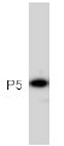 Western blot of PDIA6 in HT 1080 cell lysate using ab11432. 