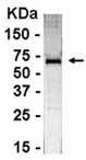 Anti-PDIA6 antibody (ab37756) at 1/2000 dilution + E coli derived fusion protein at 2.5 µgSecondaryGoat anti IgY HRP at 1/1000 dilution