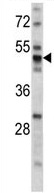 Anti-PDIA6 antibody (ab135594) at 1/50 dilution + Mouse stomach tissue lysate at 35 µg