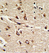 Immunohistochemical analysis of Formalin-fixed, Paraffin-embedded Human brain tissue labelling PDIA6 with ab135594 at 1/50 dilution followed by peroxidase-conjugated secondary antibody and DAB staining.