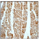 ab68164 at 1/100-1/250 dilution staining PDK2 in human muscle tissue sections.