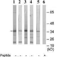 All lanes : Anti-PDLIM1 antibody (ab64971) at 1/500 dilutionLane 1 : Jurkat cell extract; without immunizing peptideLane 2 : COLO205 cell extract; without immunizing peptideLane 3 : 293 cell extract; without immunizing peptideLane 4 : HepG2 cell extract; without immunizing peptideLane 5 : HUVEC cell extract; without immunizing peptideLane 6 : HUVEC cell extract; with immunizing peptide