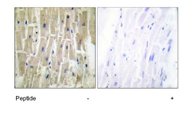 Immunohistochemical analysis of PDLIM1 in in paraffin embedded human heart tissue using ab64971 at 1/50 dilution; in the presence (left) and absence (right) of the immunizing peptide.