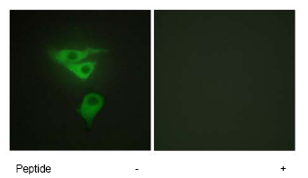Immunofluorescence analysis of PDLIM1 in HepG2 cells, with ab64971 (1/500 diltion). in the presence (left) and absence (right) of the immunizing peptide.