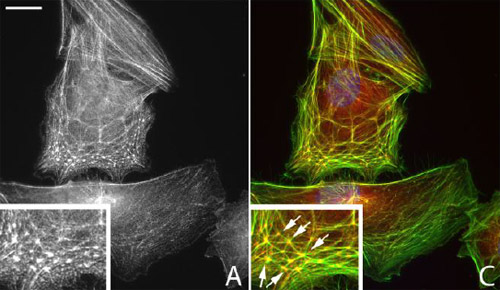 Immunofluorescence analysis of Human trabecular meshwork cells, staining PDLIM1 with ab64971. Left panel: PDLIM1 staining alone. Right panel: PDLIM1 staining (red) merged with F-actin staining (green). Cells were treated with dexamethasone, before fixing in paraformaldehyde and permeabilizing wih 0.2% Triton X-100. Cells were incubated with primary antibody (2 µg/ml) and AlexaFluor®488-conjugated phalloidin. PDLIM1 staining was detected using an AlexaFluor®546-conjugated goat anti-rabbit IgG.