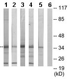 All lanes : Anti-PDLIM1 antibody (ab133711) at 1/500 dilutionLane 1 : Jurkat cell extractLane 2 : COLO205 cell extractLane 3 : 293 cell extractLane 4 : HepG2 cell extractLane 5 : HuvEc cell extractLane 6 : HuvEc cell extract with immunizing peptide