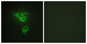 Immunofluorescent analysis of HepG2 cells labelling PDLIM1 with ab133711 at 1/100 dilution. Right panel is treated with the immunizing peptide.