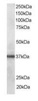 Anti-PDLIM1 antibody (ab17022) at 0.1 µg/ml + Human lung lysate in RIPA buffer at 35 µgdeveloped using the ECL technique