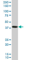 Anti-PDLIM2 antibody (ab68220) at 1/500 dilution + human liver tissue lysate at 25 µgSecondaryGoat Anti-Mouse IgG (H&L)-HRP Conjugate at 1/2500 dilution
