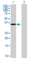 All lanes : Anti-PDLIM2 antibody (ab68220) at 1/500 dilutionLane 1 : PDLIM2 transfected 293T cell lysateLane 2 : Non-transfected 293T cell lysateLysates/proteins at 25 µg per lane.SecondaryGoat Anti-Mouse IgG (H&L)-HRP Conjugate at 1/2500 dilution