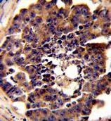 Immunohistochemical analysis of formalin-fixed paraffin-embedded mouse testis tissue, labeling PDRG1 using ab175965 at a 1/50 dilution, followed by peroxidase conjugation of the secondary antibody and DAB staining.