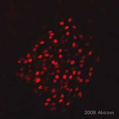 ab47383 staining mouse pancreas tissue sections by IHC-Fr.  The sections were PFA fixed and blocked in 100% Dako Serum-Free Protein Block for 15 minutes at 22°C prior to incubation with ab47383 diluted 1/10000 in PBS for 18 hours at 4°C.  An Alexa Fluor® 568 conjugated donkey anti-goat was used as the secondary.  Antigen retrieval was used with 4% PFA. Citrate buffer heated to 90°C.See Abreview