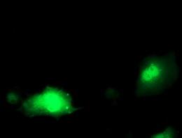 ab119051 at 1/100 dilution staining PDXK.1 in COS7 cells transiently transfected with pCMV6-ENTRY PDXK.1 by Immunofluorescence.