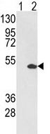 All lanes : Anti-Pea3 antibody - C-terminal (ab135590) at 1/50 dilutionLane 1 : 293 cell lysates, non-transfected Lane 2 : 293 cell lysates transiently transfected with Pea3 Lysates/proteins at 2 µg per lane.