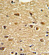 Immunohistochemical analysis of formalin fixed and paraffin embedded Human brain tissue labelling Pea3 with ab135590 at a a 1/50 dilution, followed by peroxidase conjugation of the secondary antibody and DAB staining.