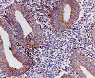 ab126610, at 1/50 dilution, staining PEAMT in Formalin-fixed, Paraffin-embedded Human uterus tissue by Immunohistochemistry.