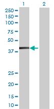 All lanes : Anti-PECI antibody (ab70512) at 1/500 dilutionLane 1 : PECI transfected 293T cell lysateLane 2 : Non transfected 293T cell lysateLysates/proteins at 25 µg per lane.SecondaryGoat Anti-Mouse IgG (H&L)-HRP Conjugate at 1/2500 dilution