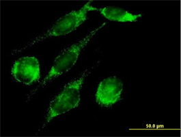 ab70512 at 10µg/ml staining PECl in Hela cells by Immunocytochemistry/Immunofluorescence.