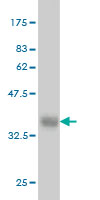Western blot against tagged recombinant protein immunogen using ab55641 PTX3 antibody at 1ug/ml.