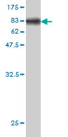Western blot against tagged recombinant protein immunogen using ab56495 NMT2 antibody at 1ug/ml.