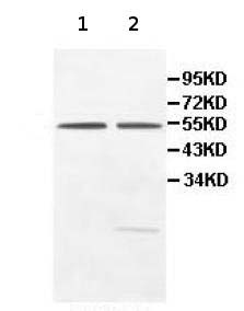 All lanes : Anti-PEPD antibody (ab111851) at 1/500 dilutionLane 1 : HeLa cell lysateLane 2 : HepG2 cell lysate