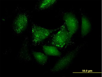 ab67862 at 10µg/ml staining PER3 in Hela cells.