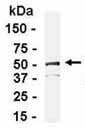 Anti-Perilipin 3 antibody (ab37504) at 1/2000 dilution + E. coli-derived fusion protein at 2.5 µgSecondaryGoat anti-IgY-HRP at 1/1000 dilution