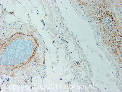 IHC image of ab92460 staining in Hu Aorta formalin fixed paraffin embedded tissue section, performed on a Leica BondTM system using the standard protocol F. The section was pre-treated using heat mediated antigen retrieval with sodium citrate buffer (pH6, epitope retrieval solution 1) for 20 mins. The section was then incubated with ab92460, 1/200 dilution, for 15 mins at room temperature and detected using an HRP conjugated compact polymer system. DAB was used as the chromogen. The section was then counterstained with haematoxylin and mounted with DPX.For other IHC staining systems (automated and non-automated) customers should optimize variable parameters such as antigen retrieval conditions, primary antibody concentration and antibody incubation times.