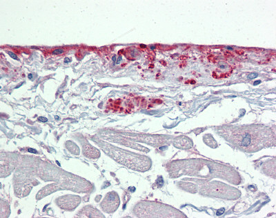 ab83690 at 5 µg/ml staining Periostin in Human heart tissue by Immunohistochemistry (Formalin/PFA-fixed, paraffin-embedded sections).