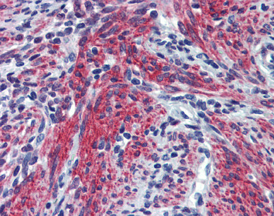 ab83690 at 5 µg/ml staining periostin in Human uterus tissue by Immunohistochemistry (Formalin/PFA-fixed, paraffin-embedded sections).